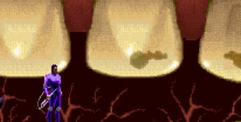 Rex Ronan: Experimental Surgeon SNES Screenshot
